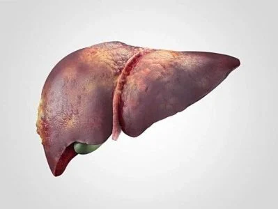 بهترین نوع قهوه برای کبد چرب