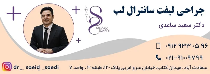 سانترال لب چیست و چگونه انجام می شود؟