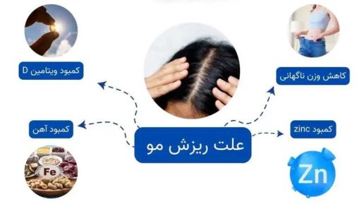 علت و راهکارهای درمان ریزش موی شدید و ناگهانی