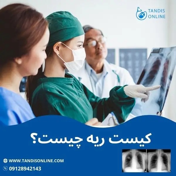 کیست ریه چیست و چگونه اجاره اکسیژن ساز می تواند در درمان این مشکل موثر باشد؟