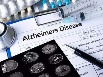 آلزایمر نشانه های آلزایمر از چند سالگی شروع می شود؟