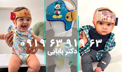 آشنایی با محل و وظیفه ملاج سر نوزاد